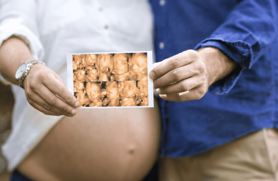 ¿Cuántas ecografías en el embarazo son necesarias?