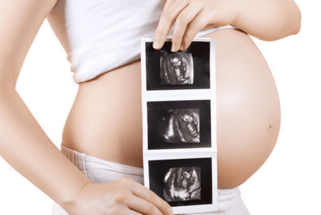 ¿Para qué sirven las ecografías en el embarazo?