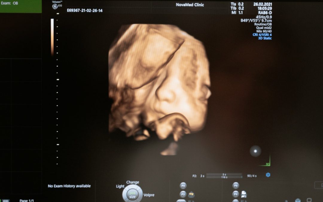 Los gestos de tu bebé en las ecografías