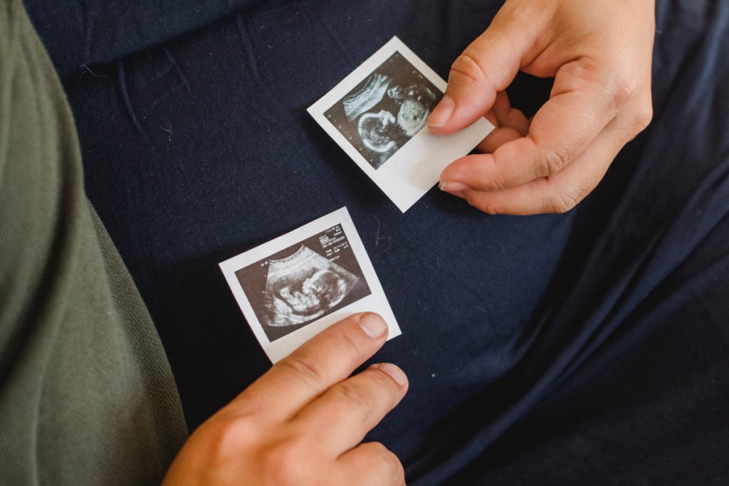 ¿Cómo ver los gestos de tu bebé en el útero materno?