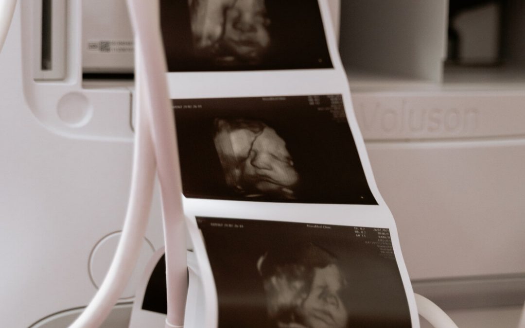 ¿Cuándo realizar una Ecografía 5D?