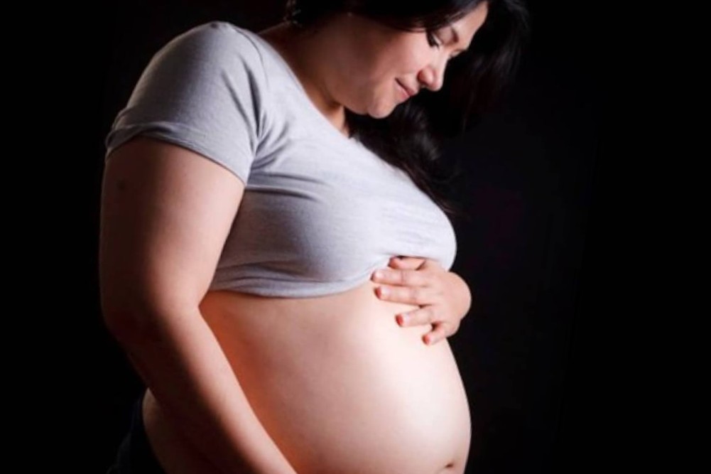 ¿Cómo puede afectar en el embarazo la obesidad en la mujer?