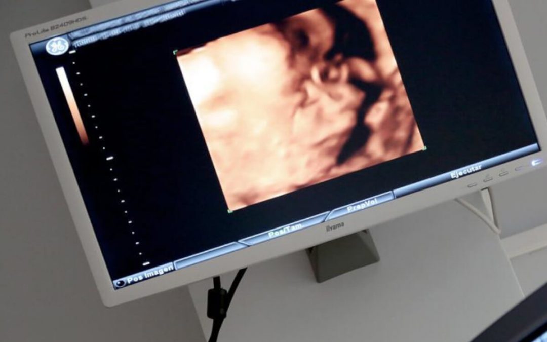 ¿Qué es una ecografía?