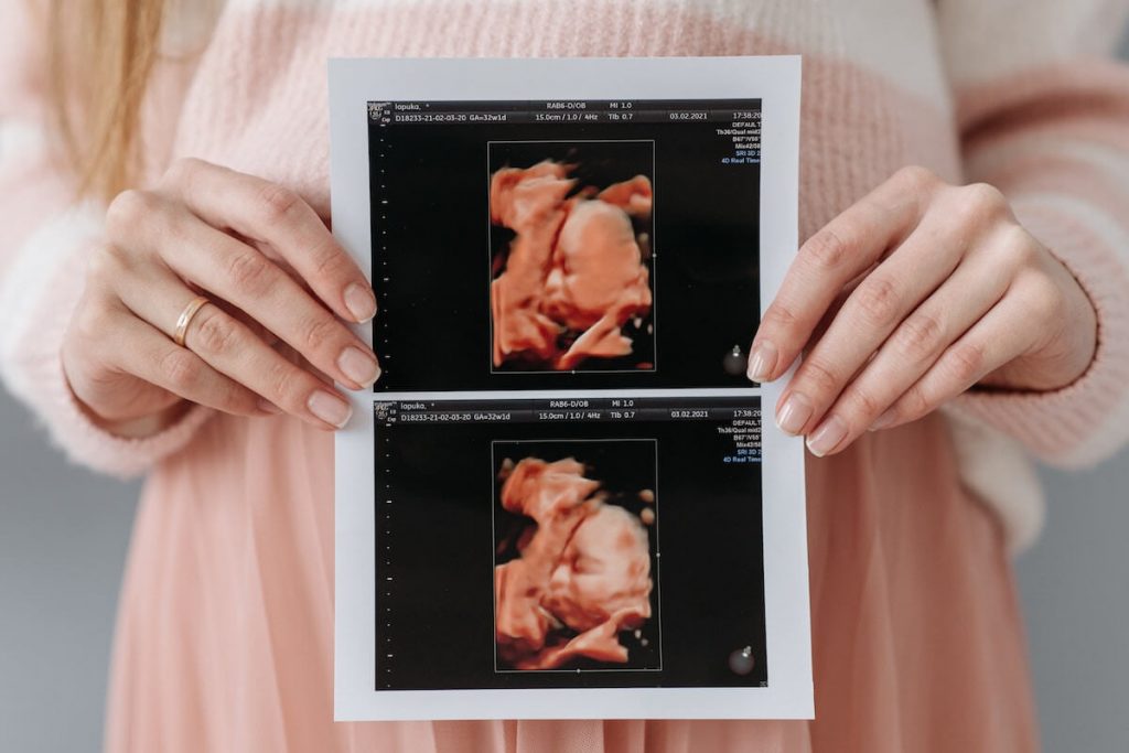 ¿La ecografía prenatal es segura?