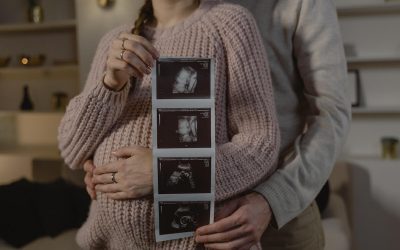 Que es una ecografía prenatal